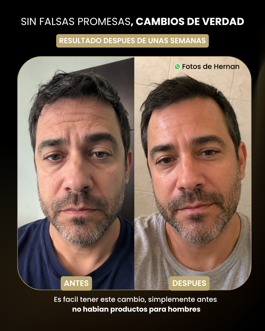 TAURO - Serum Facial Masculino